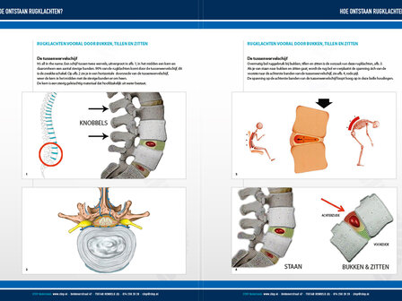 STEP BROCHURE: PDA - RUGKLACHTEN DOOR BUKKEN, TILLEN EN ZITTEN